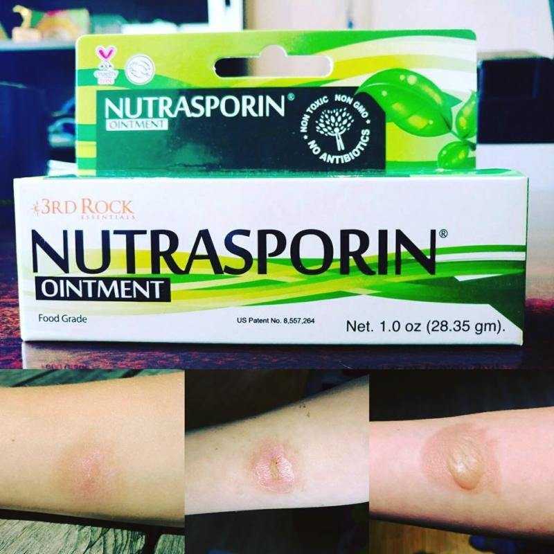 Nutrasporin Silver Gel ointment soothing burn healing naturally without scars